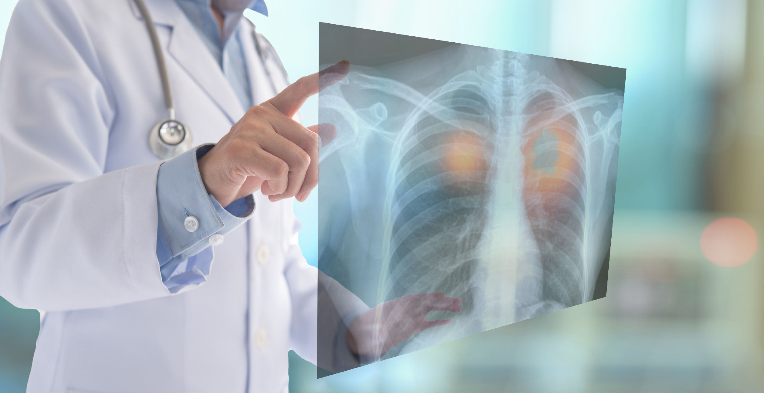 Células inmunes “enloquecidas” ocasionarían daño pulmonar